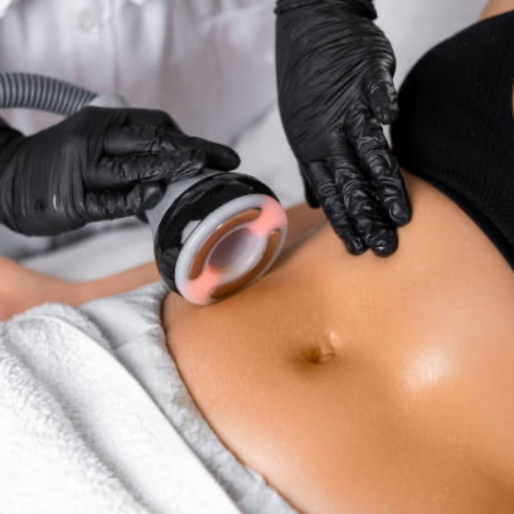 Cavitation at Beth  Shull in Rock Hill, SC