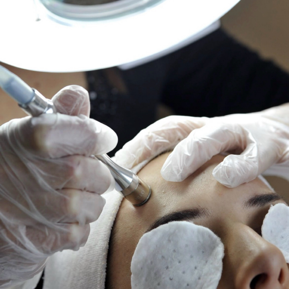 Microdermabrasion Facial-Treatment at The Face Lounge by Blair in Columbia, MS