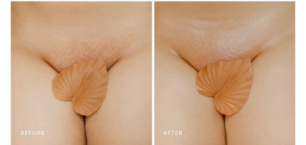 Brazilian Wax Touch Up