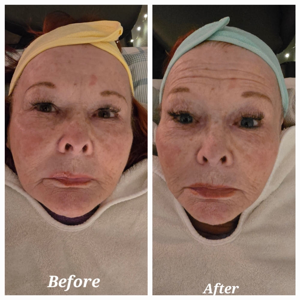 Microcurrent Face Lift at ReSet Self Care Therapy Day Spa in Anchorage, AK