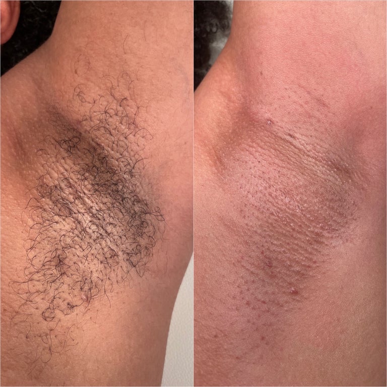 Underarm Wax at Skin by Li LLC in Manchester, CT