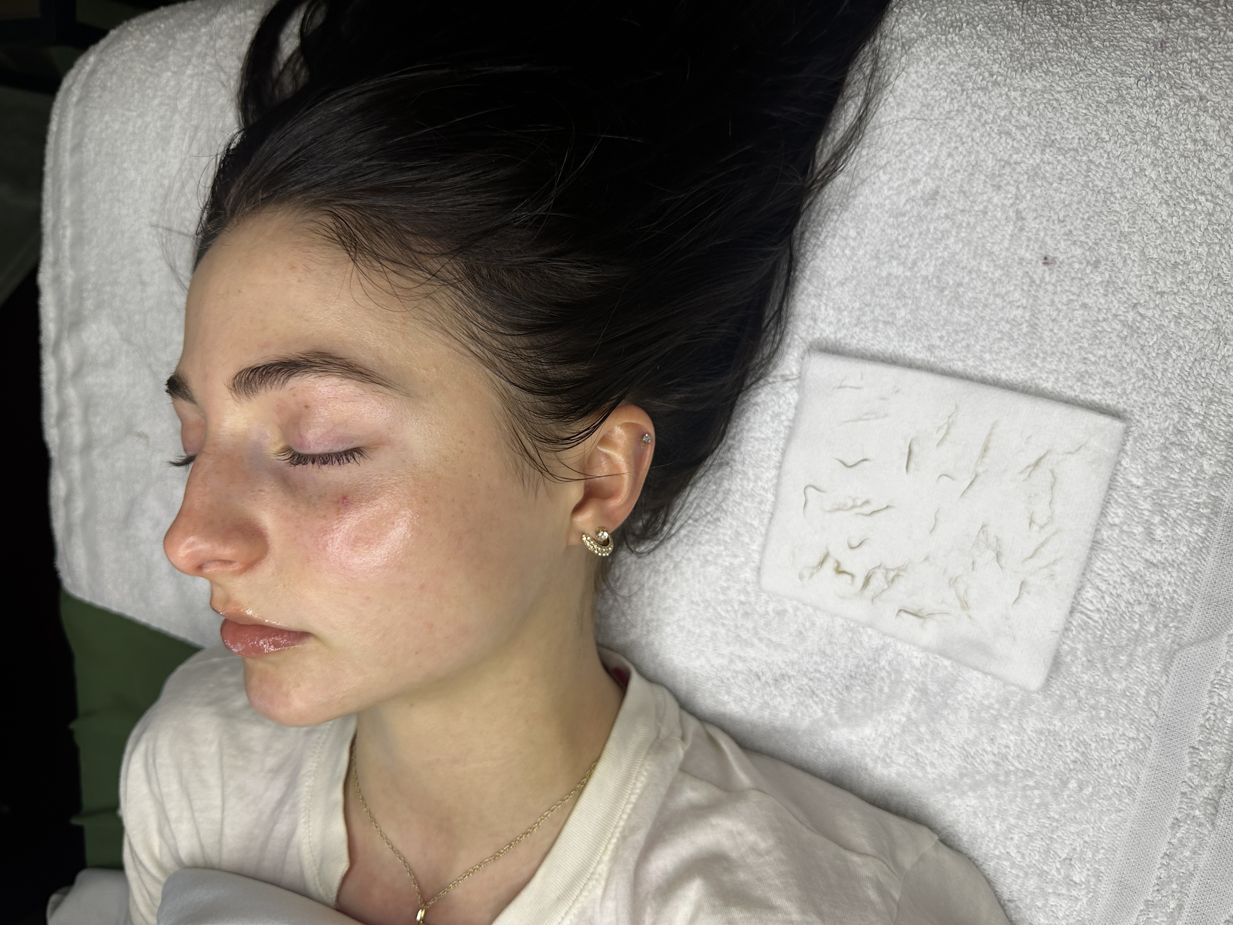 Dermaplane Facial at ZOLA Beauty Bar in Evansville, IN