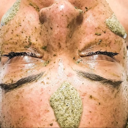 Deep Sea Herbal Peel at Brow Envy By Ruchi in Burlingame, CA