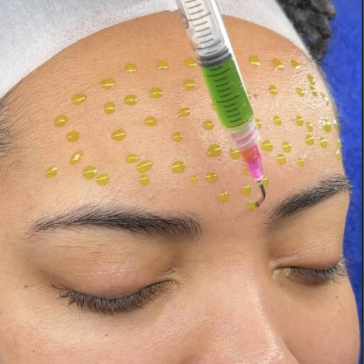 BioRePeelCl3® at Skin & Soul in Brooklyn, NY