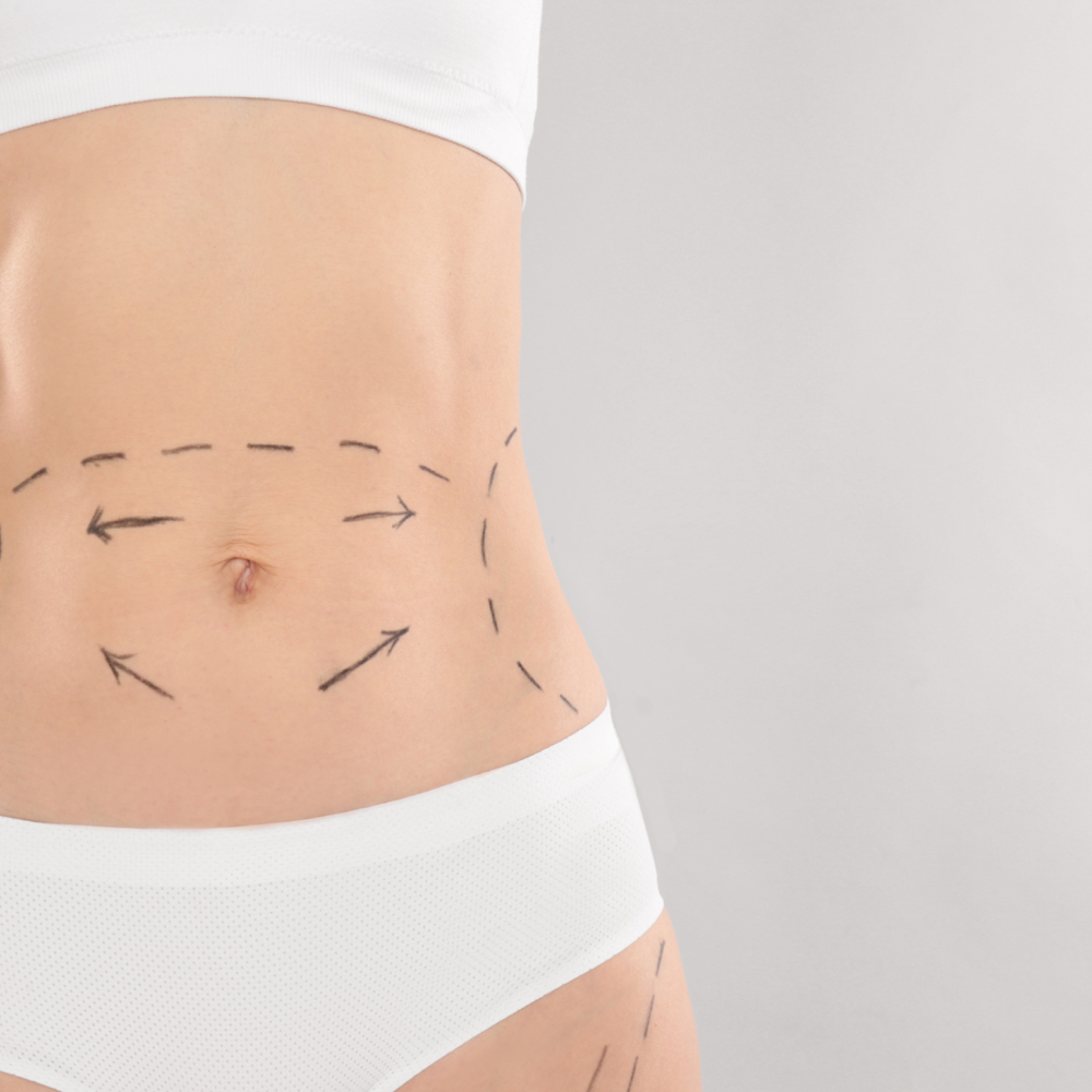 Post-Operative Lymphatic Drainage