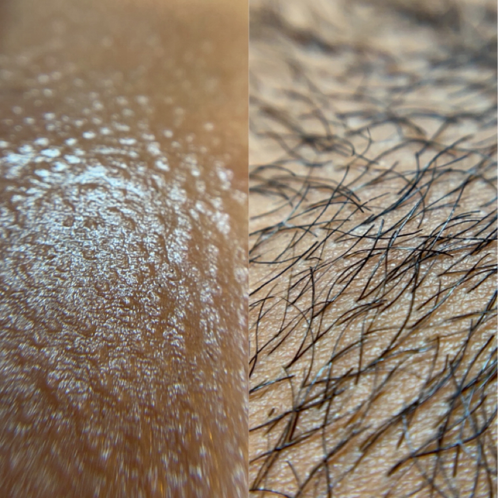 Brazilian Wax at Your Waxthetician in San Antonio, TX
