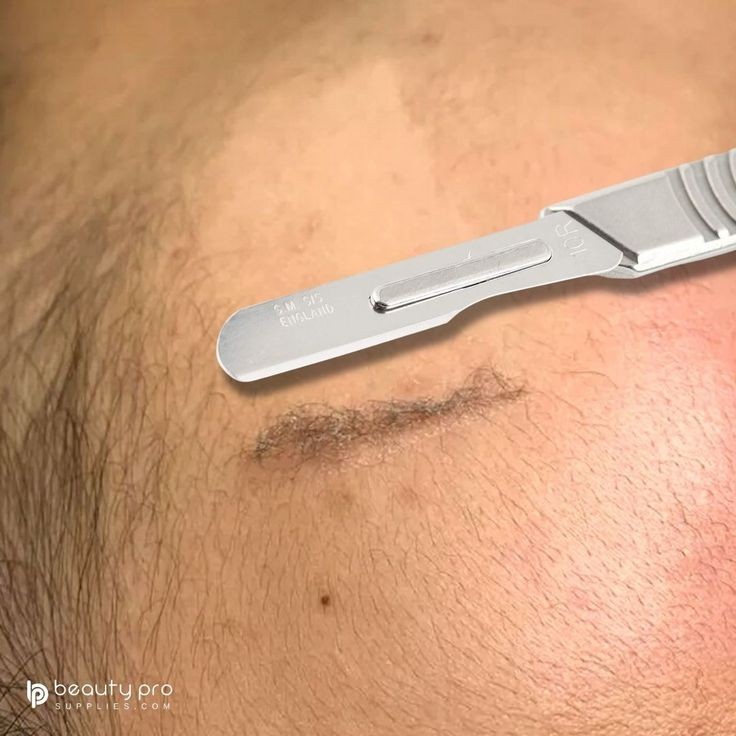 Facial And Dermaplaning
