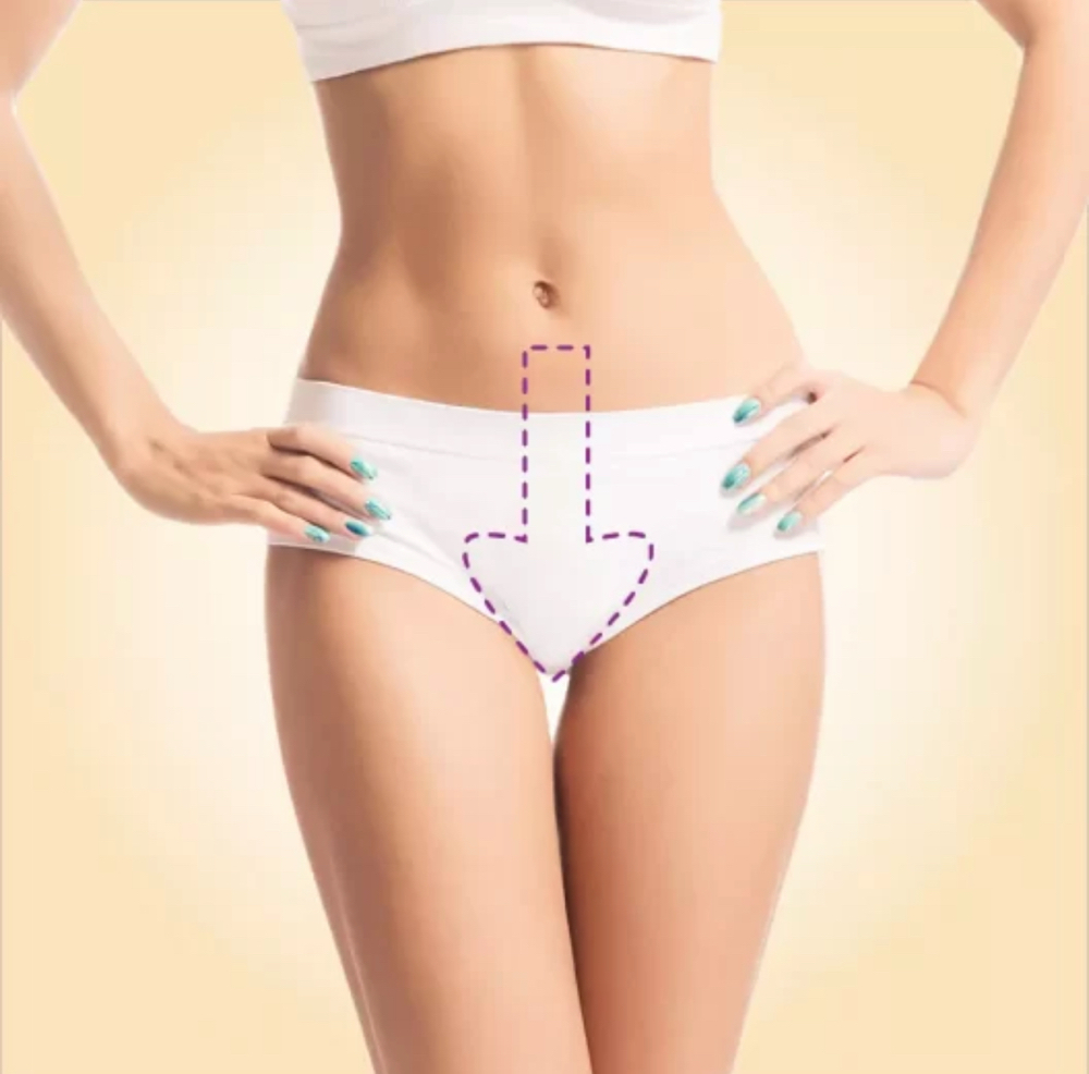 Brazilian Wax / Virilha Completa