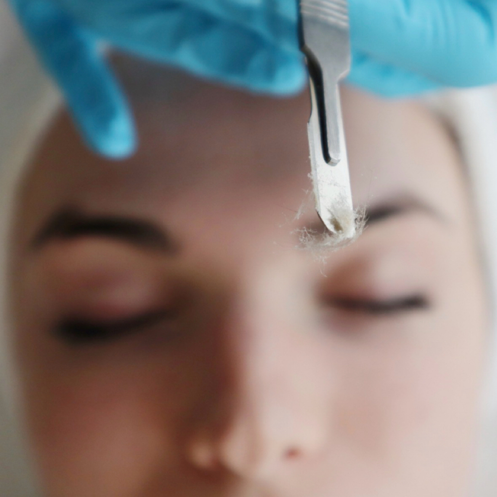 Silk Renewal Treatment at Hy Maintenance Skin in Atlanta, GA