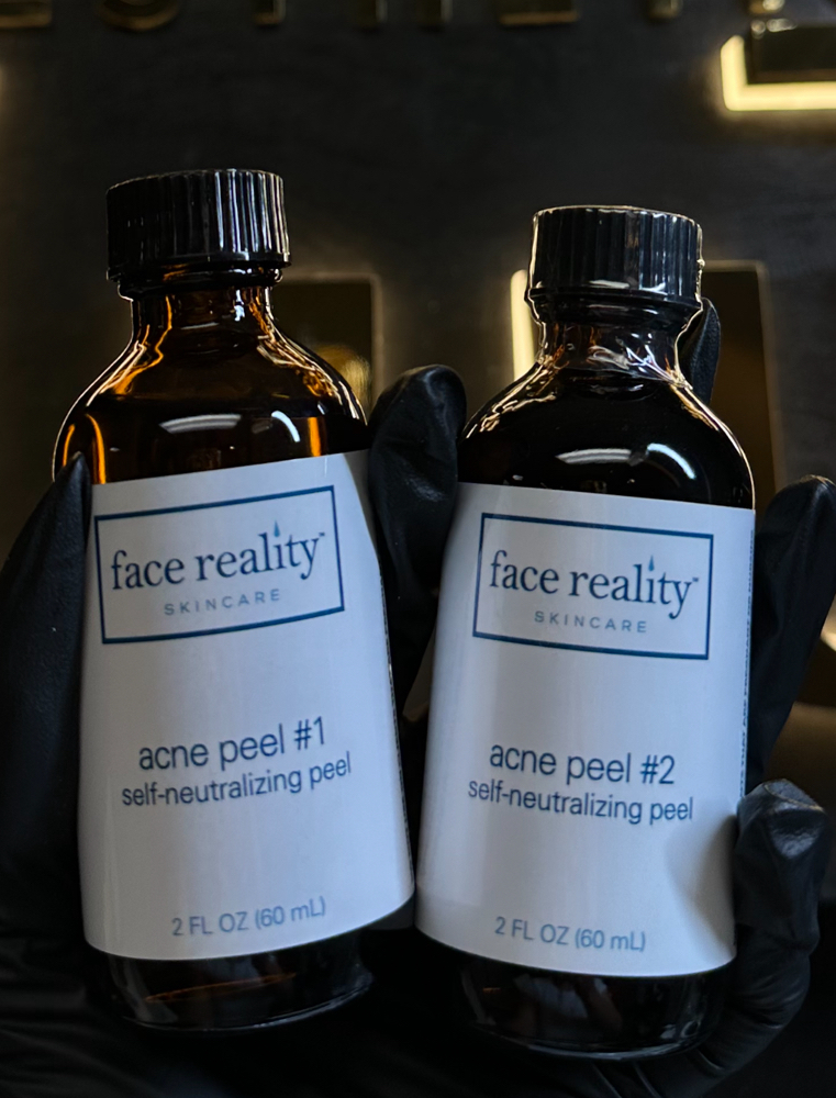 SERIES OF 3 CHEMICAL PEELS