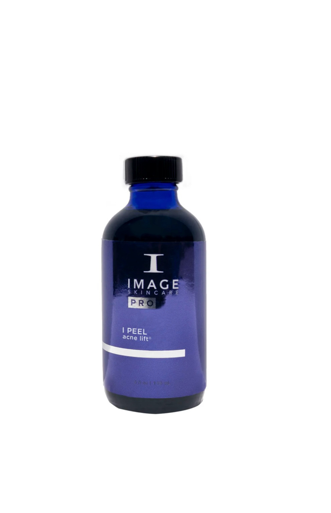 Acne Chemical Peel