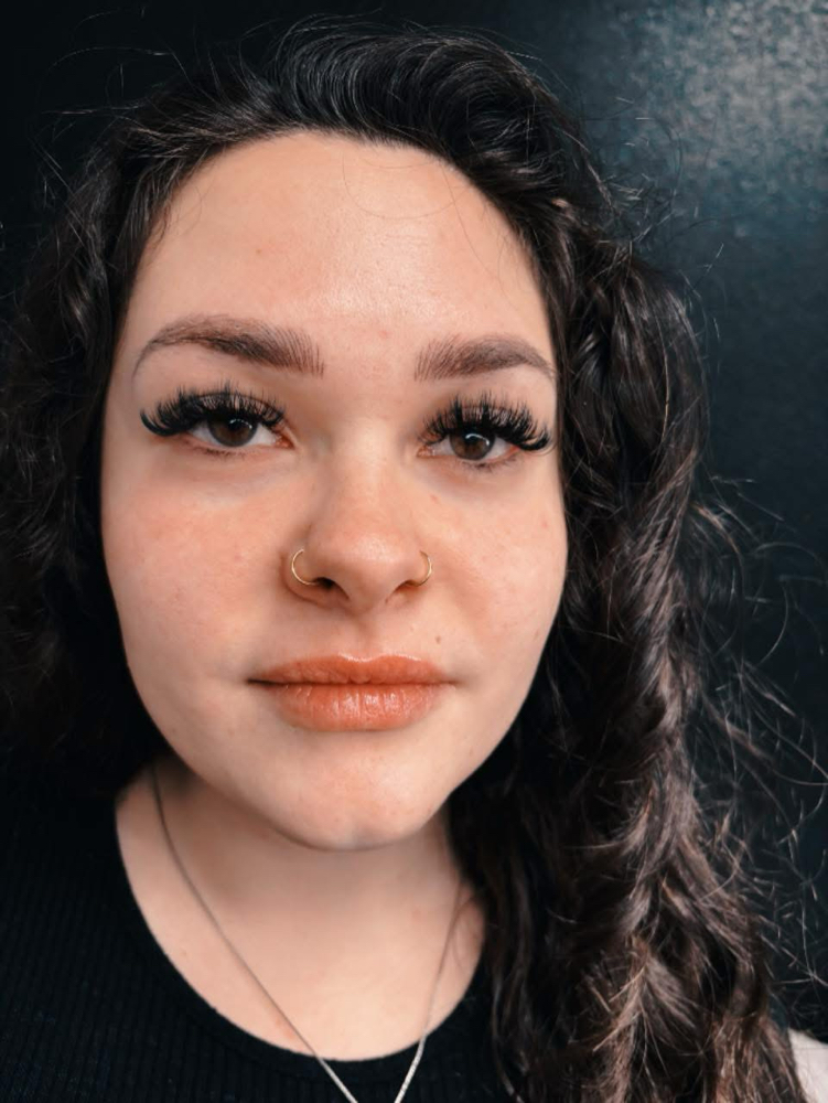 Mini fill. (3-7 days)