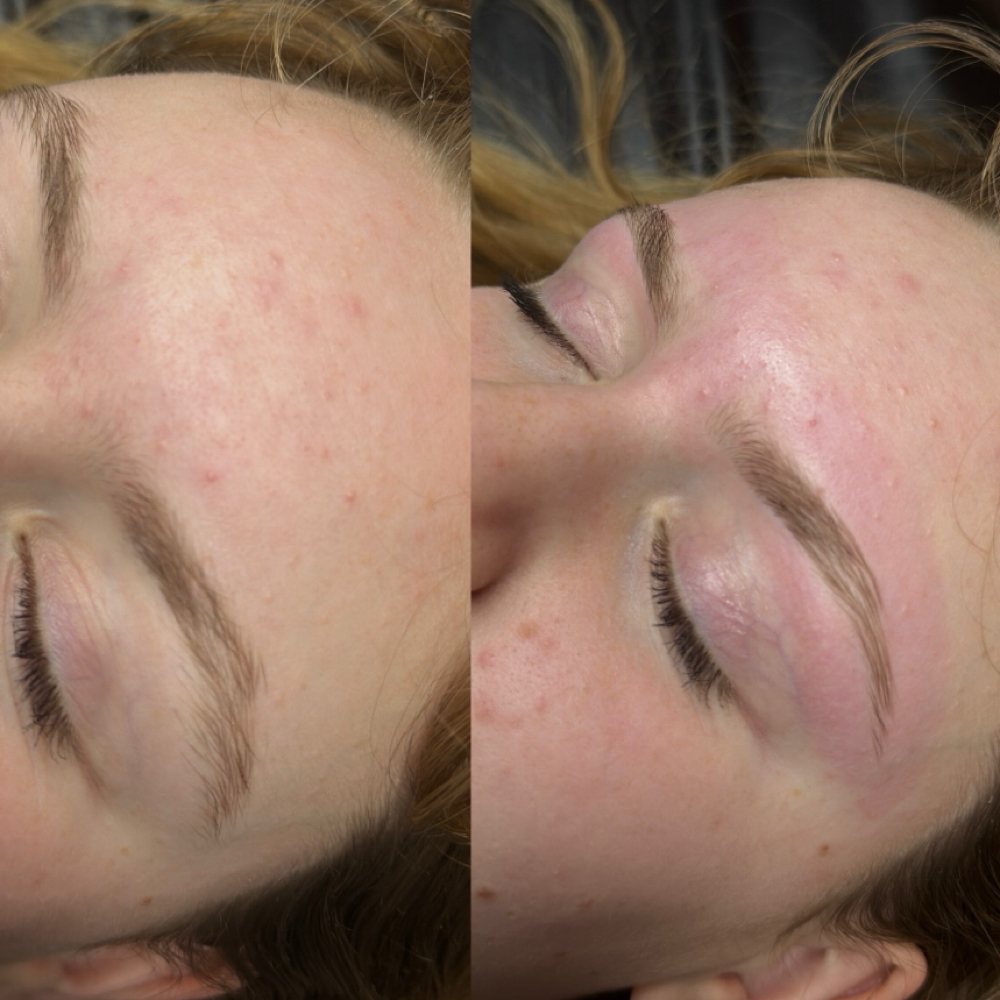 Brow Wax at Complexion Perfection in Templeton, MA
