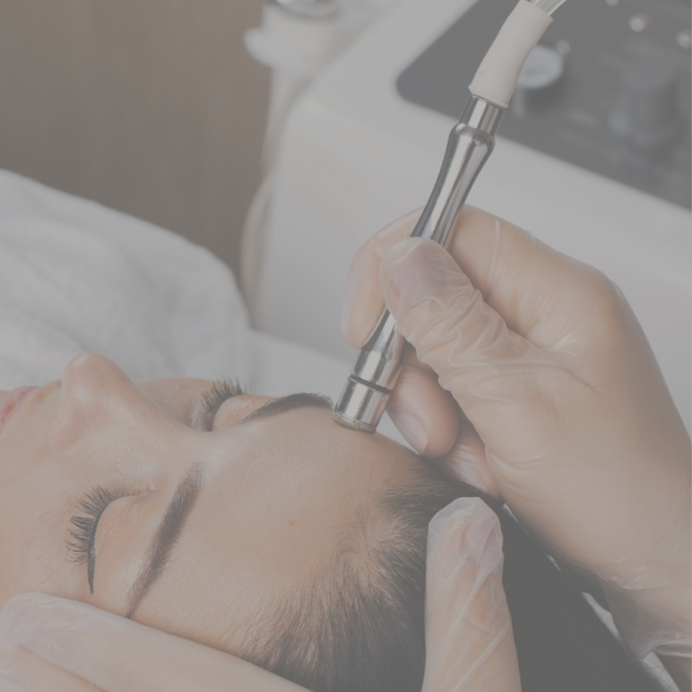 Microdermabrasion Facial