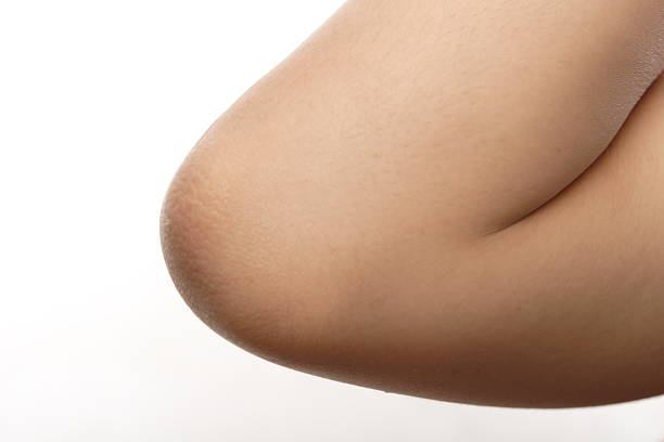 ELBOW BLEACHING TREATMENT at Star Spa Lash & Brow By: Evelyn Esthetician in Oakland, NJ