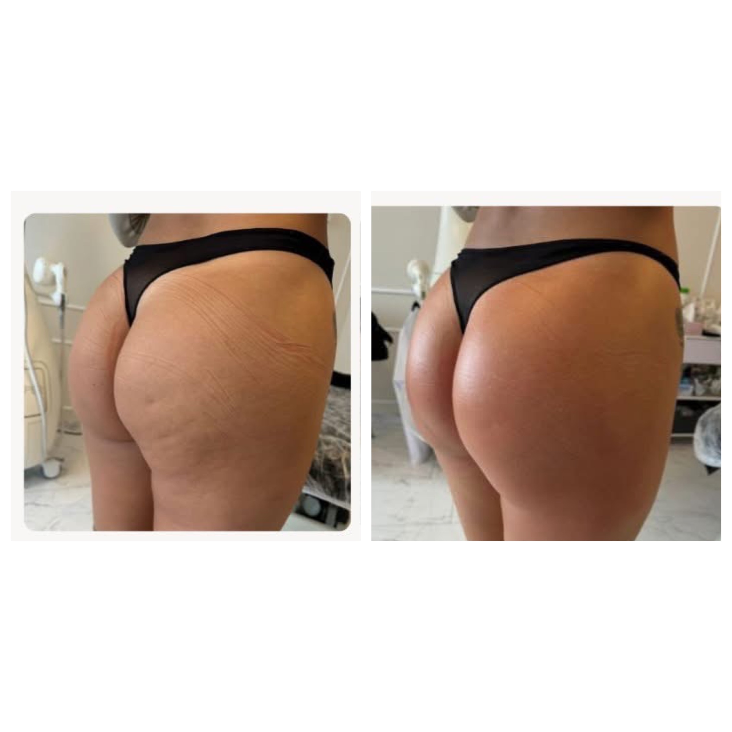 Liquid BBL Gold PRP 100% Natural