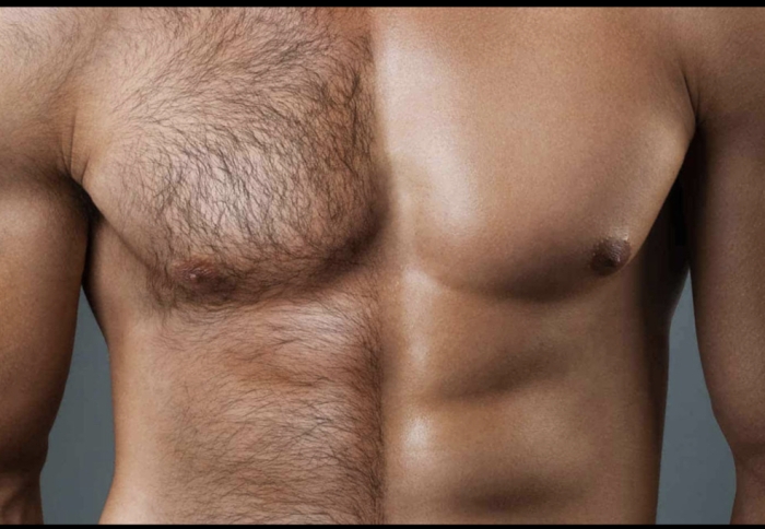 Chest