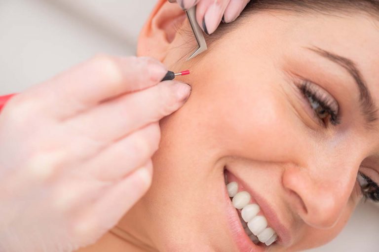 Electrolysis
