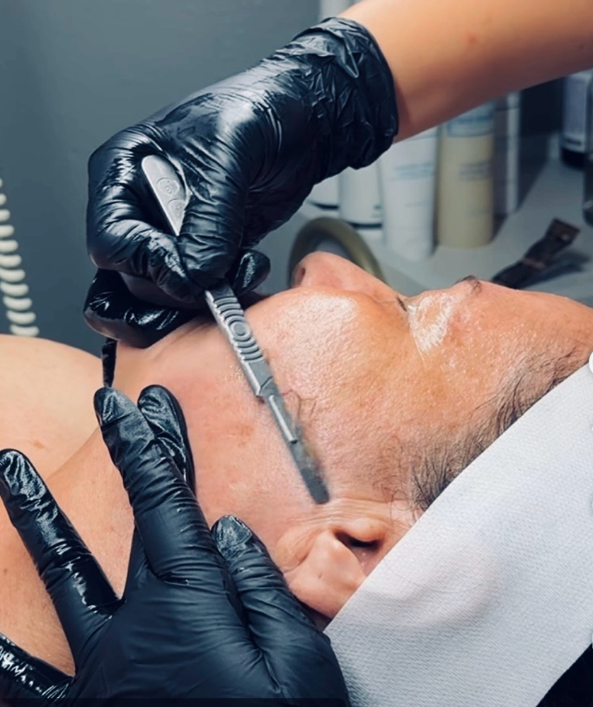 Dermaplane