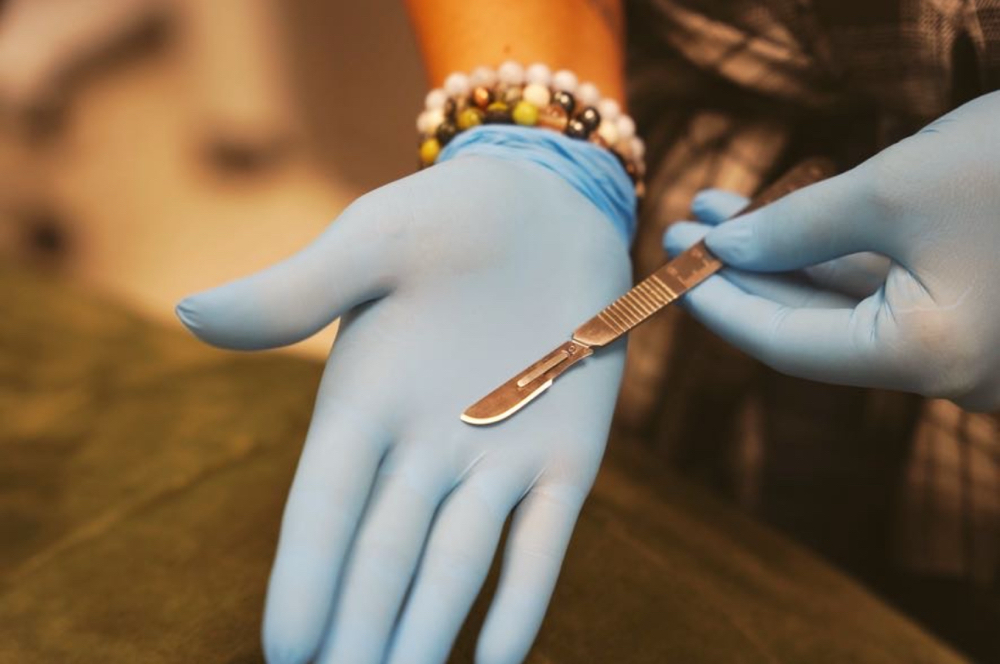 Dermaplaning