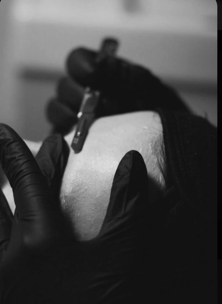 Dermaplane