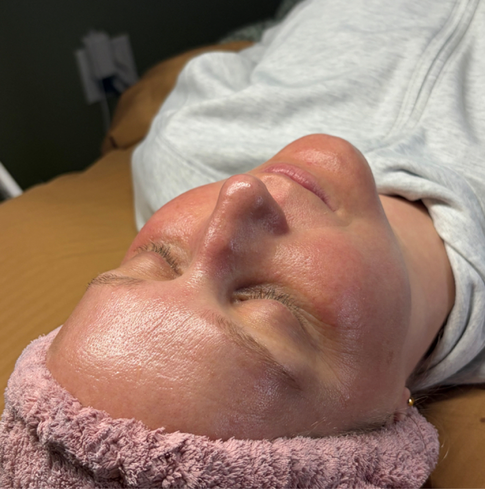 Hydrodiamond Refresh Facial at Bare by Kelsey in Gaylord, MI