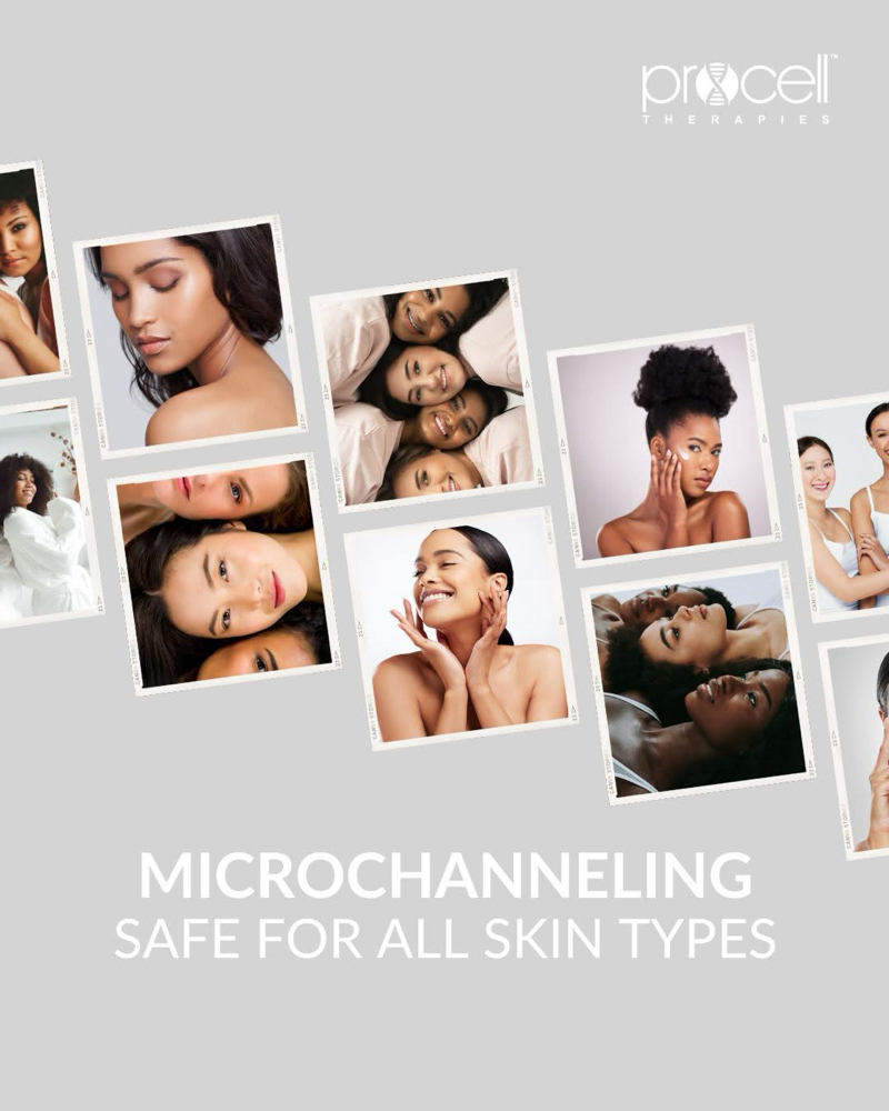 Procell Microchanneling Facial