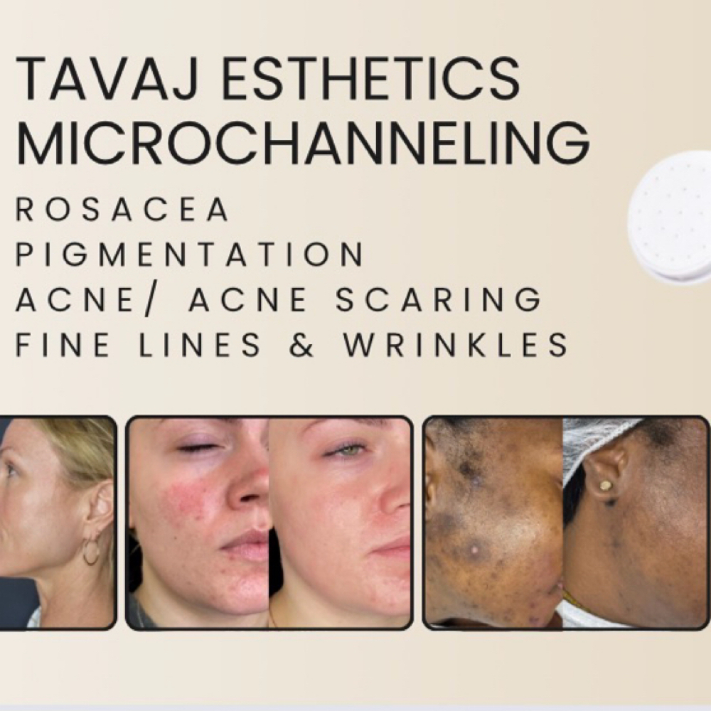 Cellular Renewal Facial at Tavaj Esthetics in Sewell, NJ