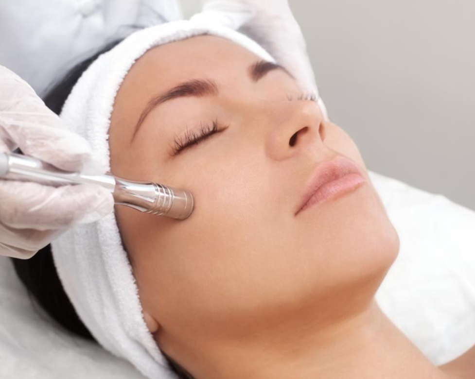 Microdermabrasion Facial