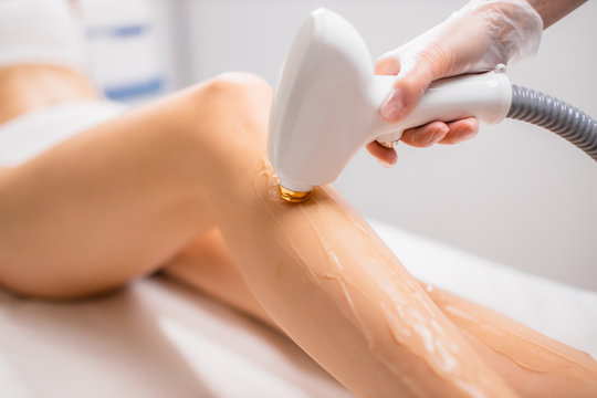 Laser Hair Removal  -  Large Areas