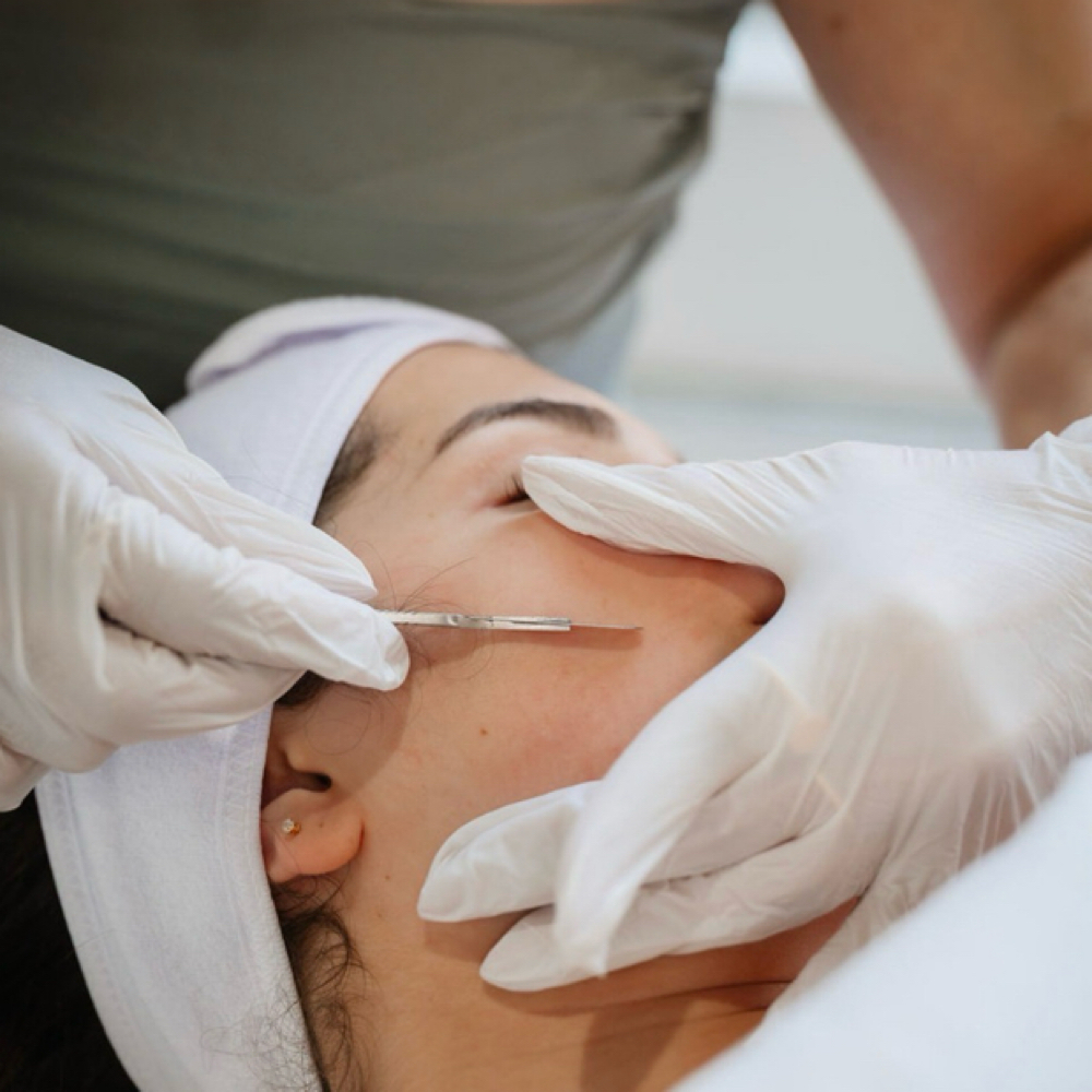 Dermaplaning at The Rosie Touch in Valley Village, CA