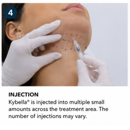 KYBELLA INJECTION 714-981-2043 at America Medical Esthetics Services in Santa Ana, CA