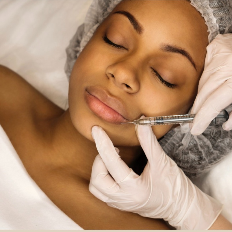Evolysse Smooth and Form (Fillers) at Theia Medical Spa in Vinings, GA