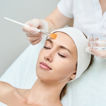Chemical Peel at June Aesthetics in Spring Hill, KS