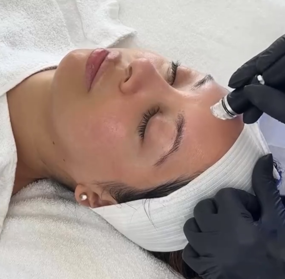 HydroGlow Facial
