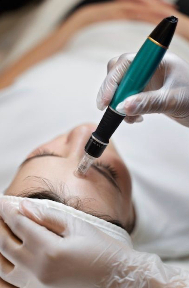 Collagen Induction Therapy at Espy Esthetics in Midland, TX