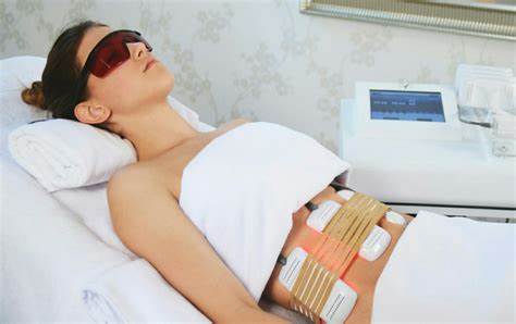 Laser Lipolysis