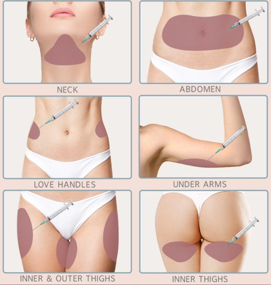 Fat Dissolving Therapy at Rethink Aesthetics in Manhasset, NY