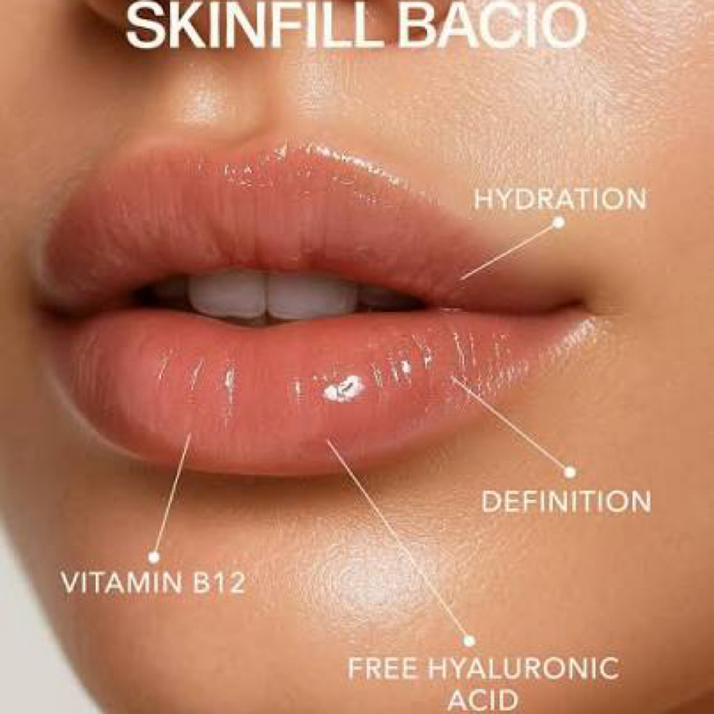 💉SKINFILL BACIO at RGV PRIME AESTHETICS PLLC in Mcallen, TX