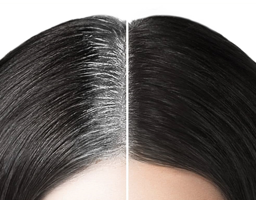 Roots Only (Gray Coverage)