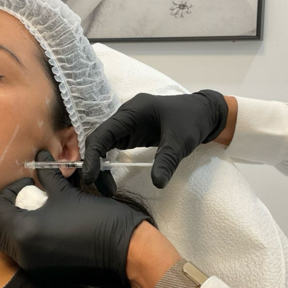 Botox/Dysport- Masseter at Sharon Nicole Aesthetics in Patchogue, NY