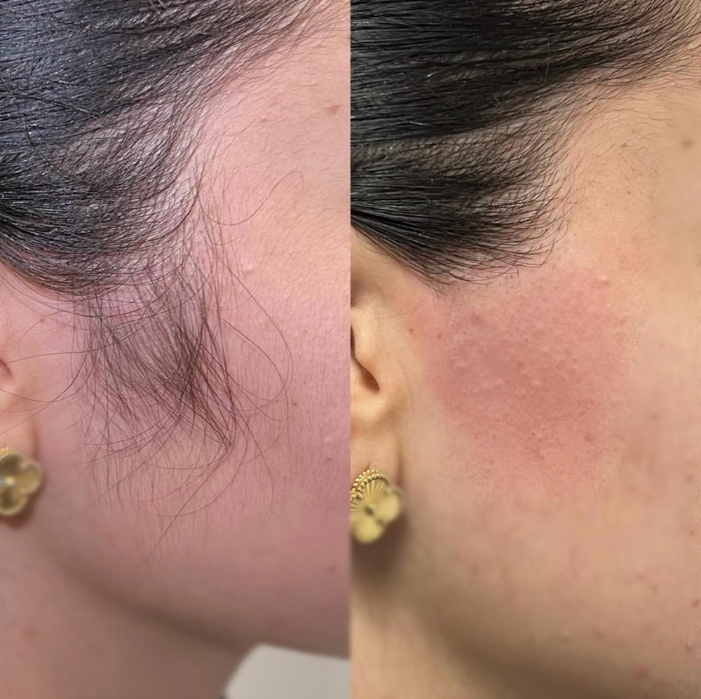 Side Burns Wax