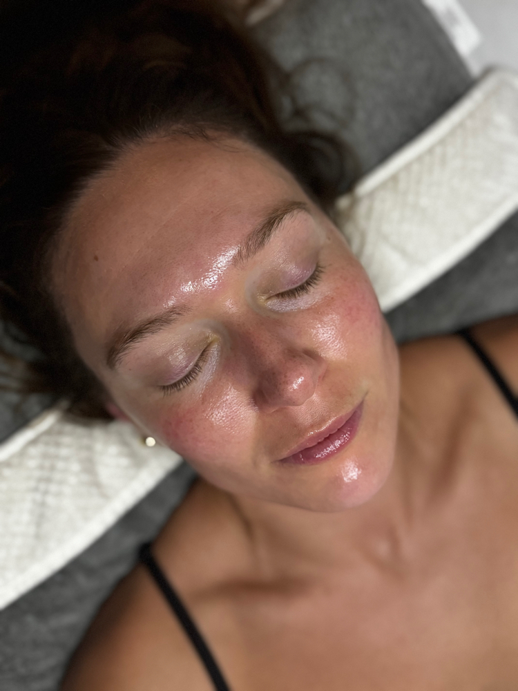 Custom Peel
