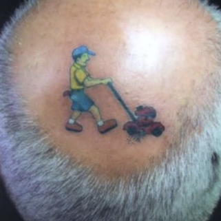 Laser Tattoo Removal at Willow & Wood in Salina, KS