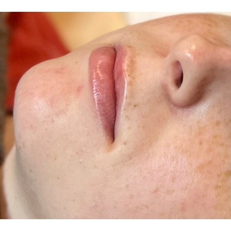Lip or Eye Treatment