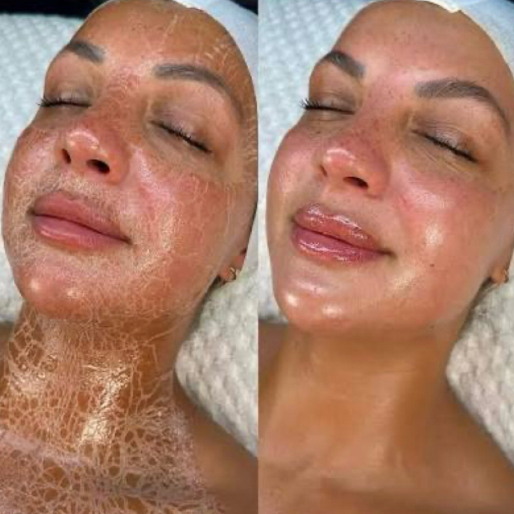 The Luminous Lift Facial at Euphoria Beauty in Reading, PA