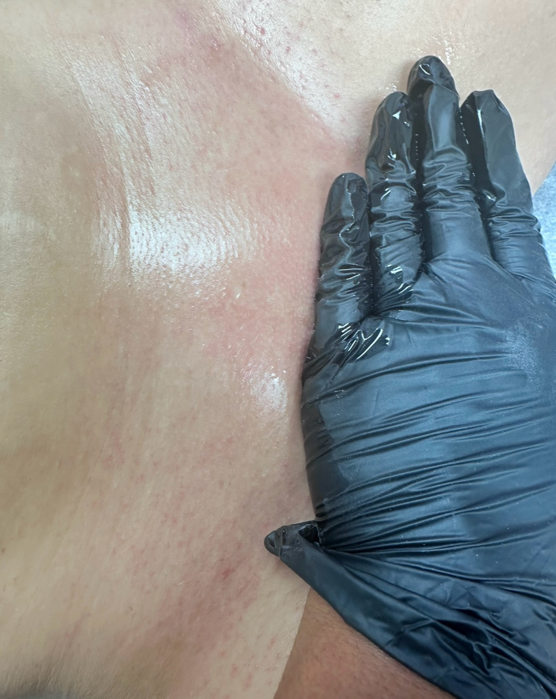 Brazilian Wax. (V)