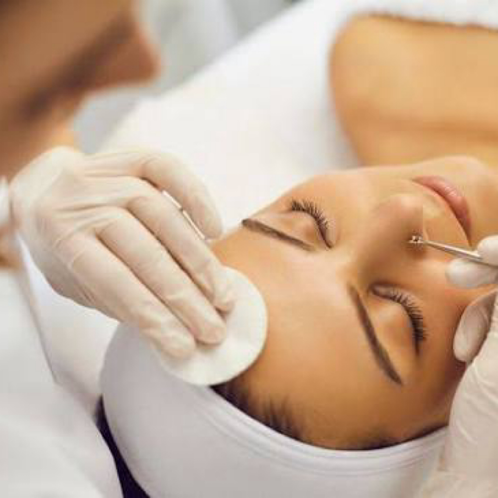 Acne Facial at Dream Salon in Eagle Point, OR
