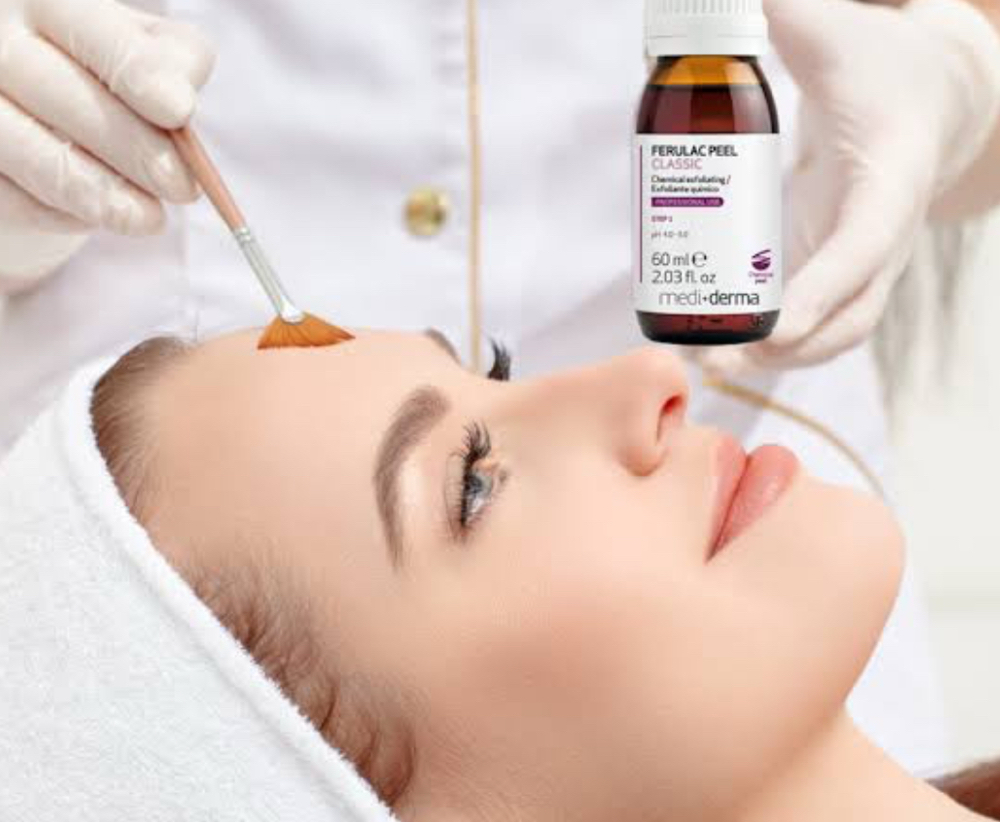 Facial Peeling Ferulam at Selflovebyely in Ocala, FL