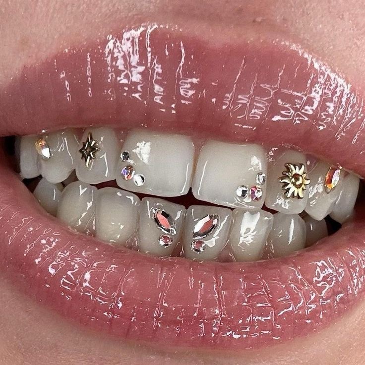 (NEW!) Tooth Gems✨